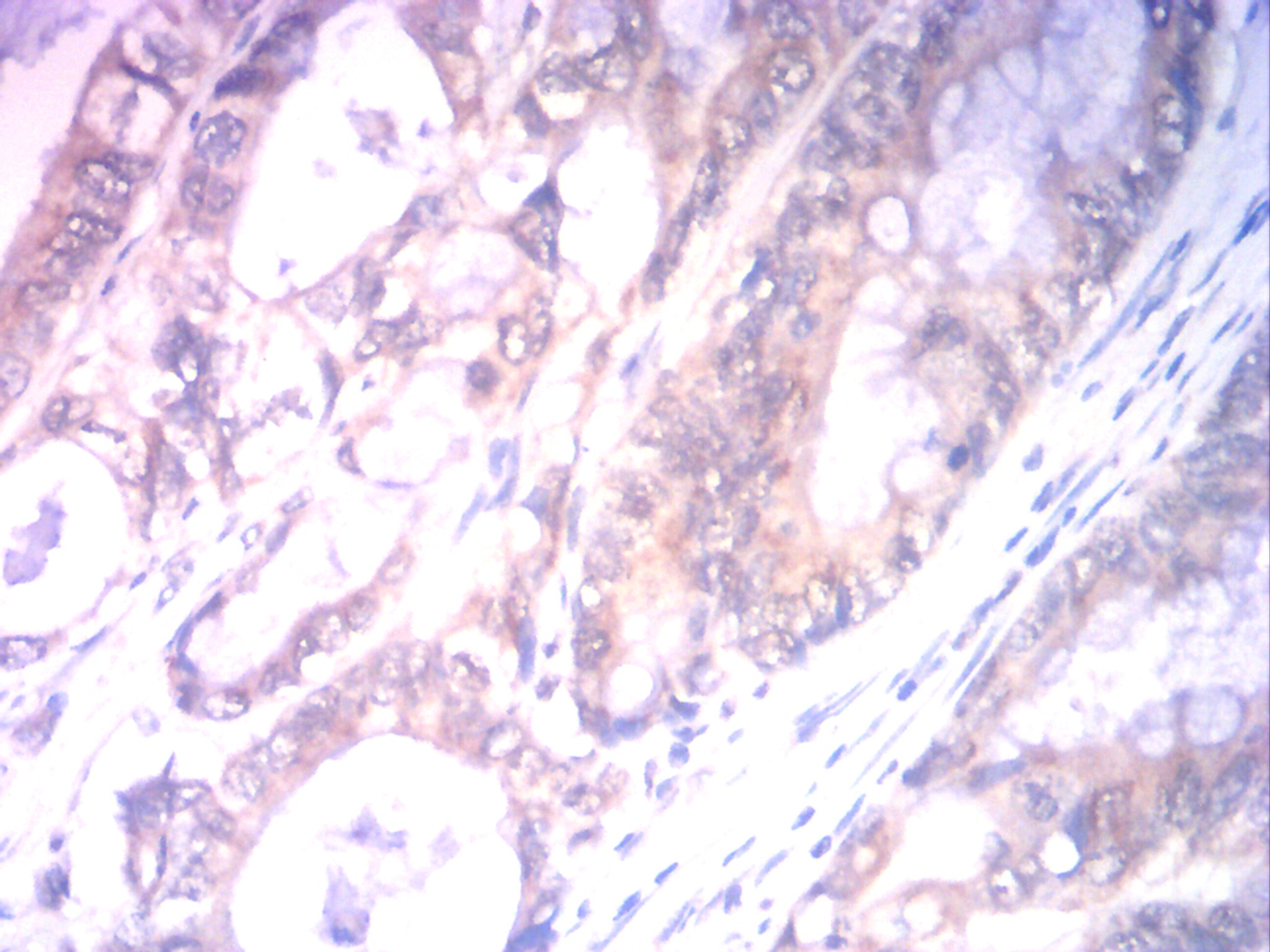 IHC